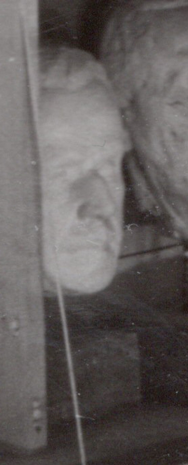 Porträt Hans Meyer-Burkhard